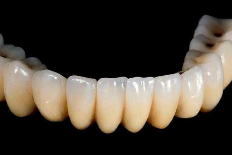 Стоматологическое сообщество в Дубае планирует запустить 3D-печать зубов в этом году