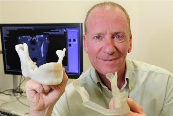Британский пациент излечился от рака и обрёл новую челюсть благодаря 3D-принтингу