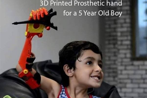 Детский протез теперь выглядит как рука супергероя благодаря Bioniks и 3D-принтингу
