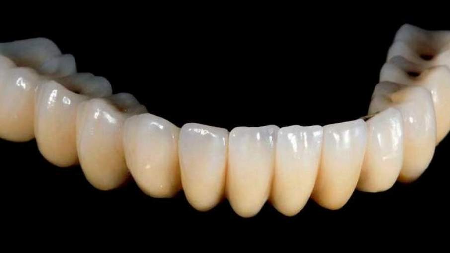 chrome-teeth-906x509.jpg