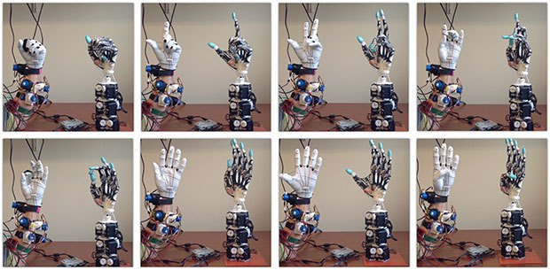 Протез руки, созданный с помощью 3D технологий, имитирующий настоящую руку